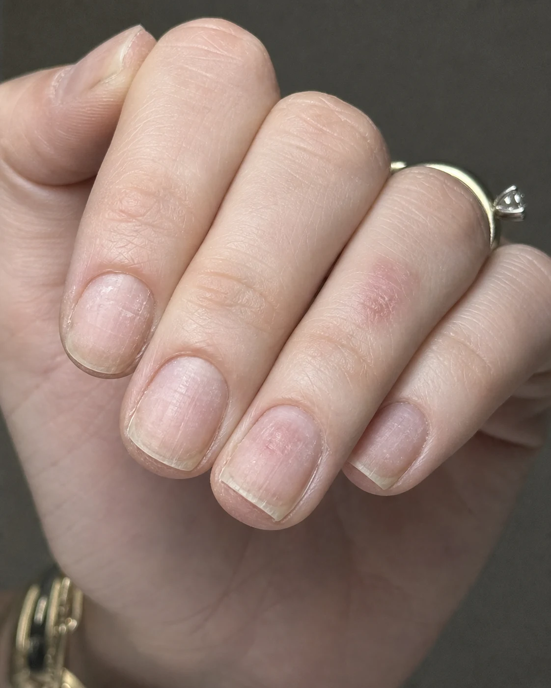Neon nail art ve mavi kalıcı oje öncesi doğal tırnak