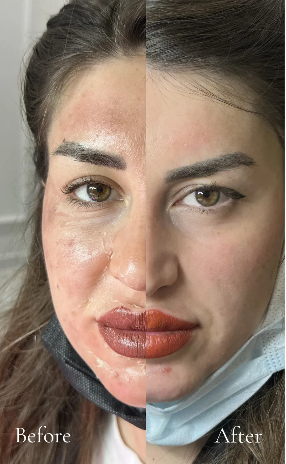 Before after cilt bakımı sonucu