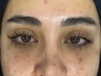 Kirpik ve Kaş - ipek kirpik, kirpik lifting, kaş laminasyonu