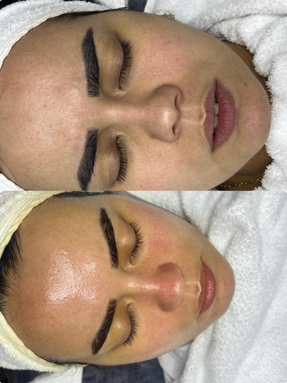 Klasik cilt bakımı - Yaşamkent &Ccedil;ankaya g&uuml;zellik merkezi